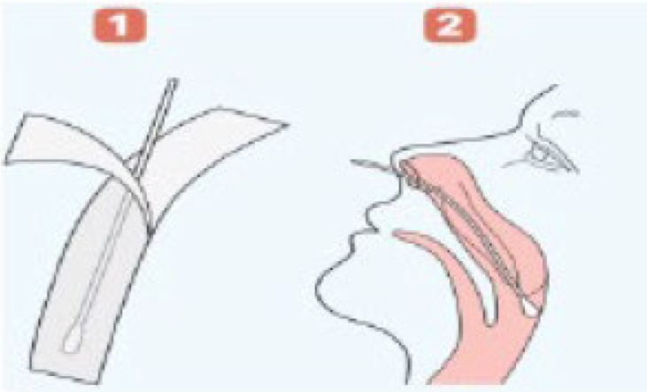 口腔咽頭での採取方法1